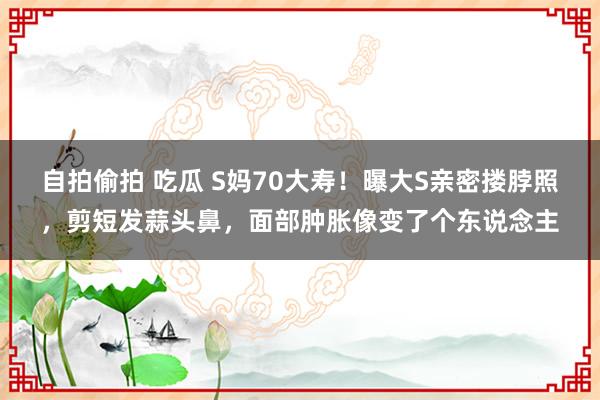 自拍偷拍 吃瓜 S妈70大寿！曝大S亲密搂脖照，剪短发蒜头鼻，面部肿胀像变了个东说念主